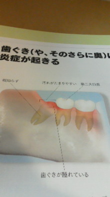 スタッフによるブログです。-201212081723000.jpg