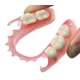 ノンクラスプ床義歯